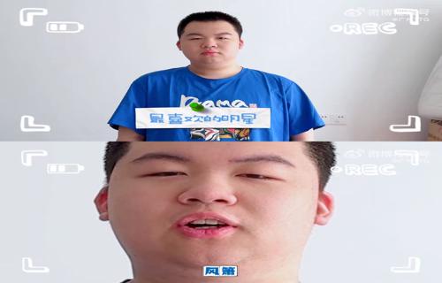 杨佑宁的故事让我们认识到美丽不仅仅是外在的装饰更是内心的自信和力量她用自己的行动向我们证明真正的美丽